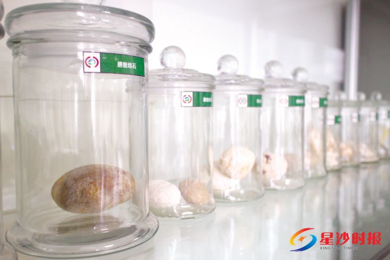 　　长沙市中医医院（长沙市第八医院）肝胆外科、泌尿外科办公室陈列着各种各样的“石头”，它们都是从患者体内取出来的“战利品”——结石。 林畅 摄